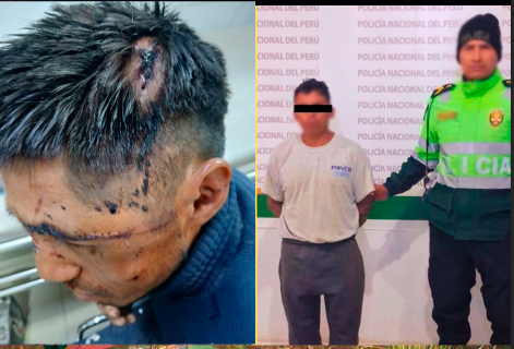  DETIENEN A SUJETO ACUSADO DE CAUSAR GRAVES LESIONES CON UN PICO EN TALAVERA